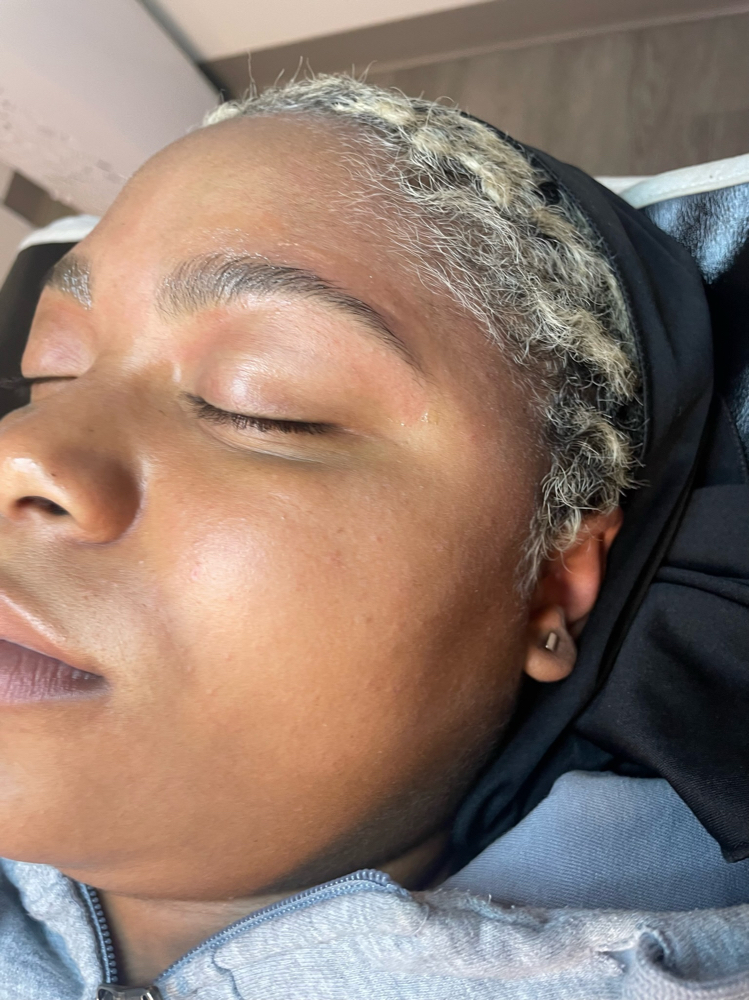 Brow Mapping