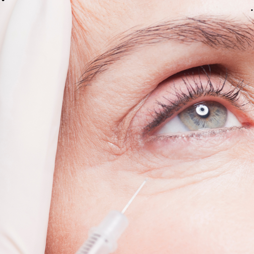 Advanced Tear Trough Rejuvenation at Empower Aesthetics in Canyon Lake, TX