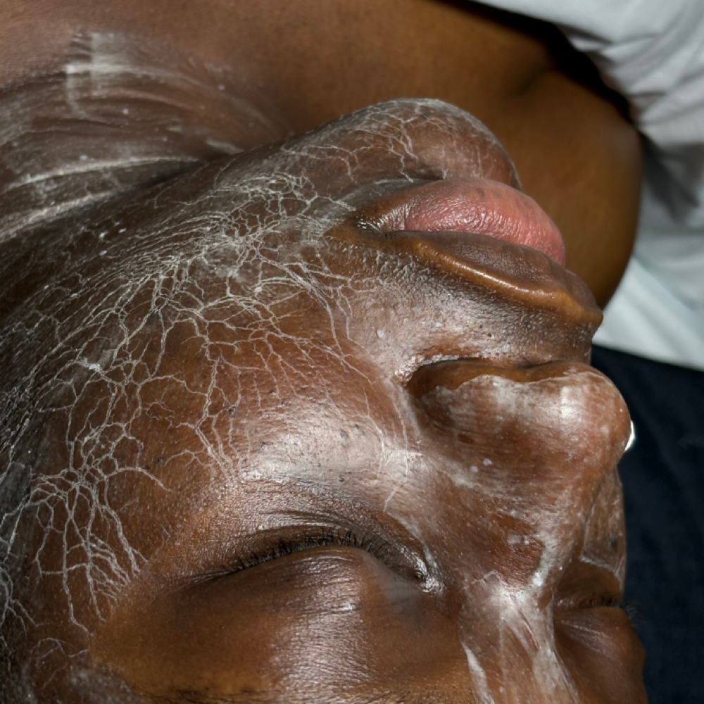 Protien Powerlift Facial at SkinCarebyVaeh in West Fargo, ND