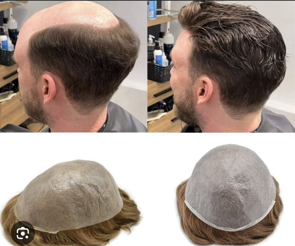 Hair System