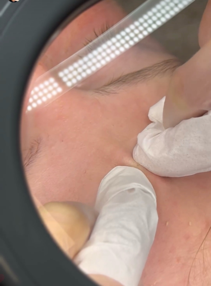 Deep Extraction