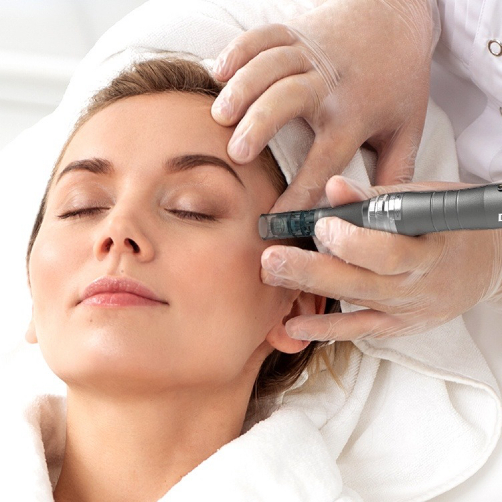 Microneedling at Lotus & Mäne in Fayetteville, NC