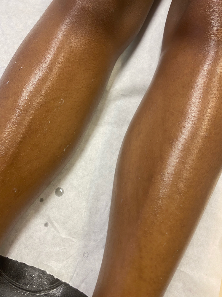 Half Leg at Deasia Brewer in Chattanooga, TN