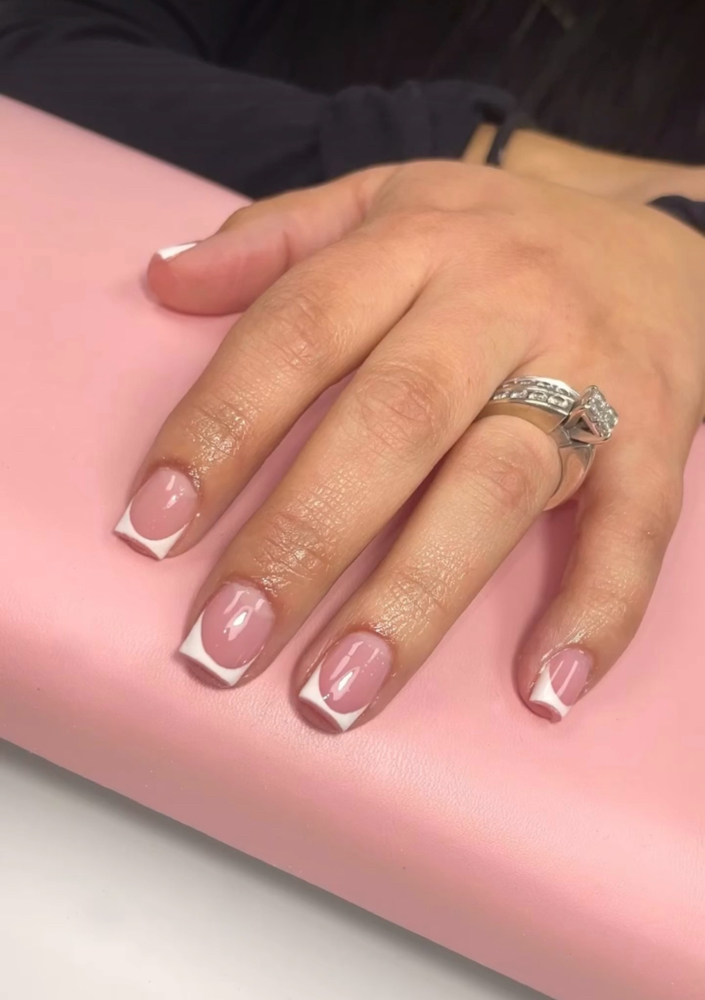 Acrylic Overlay
