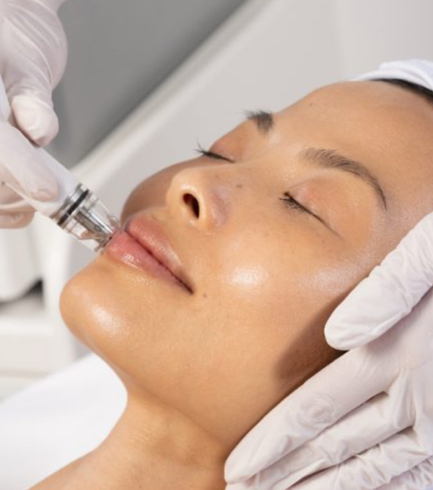 Limpieza Facial+Exosomas+PDRN at Selflovebyely in Ocala, FL