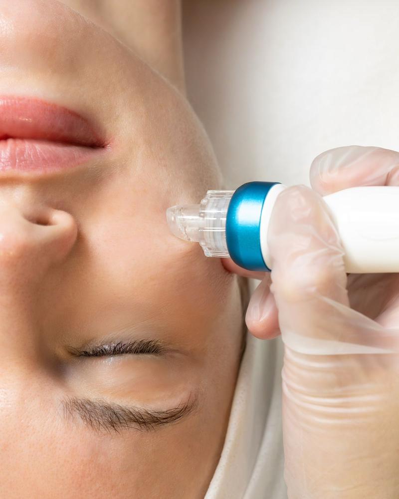 Deep Clear Hydrafacial MOM PROMO at ShanaSkincare in Gainesville, FL