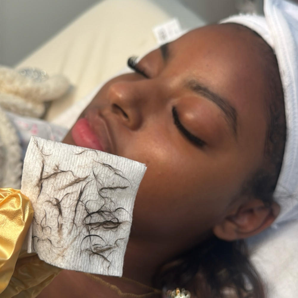 Dermaplane Facials 🫧 at The Spot Beauty in Phoenix, AZ