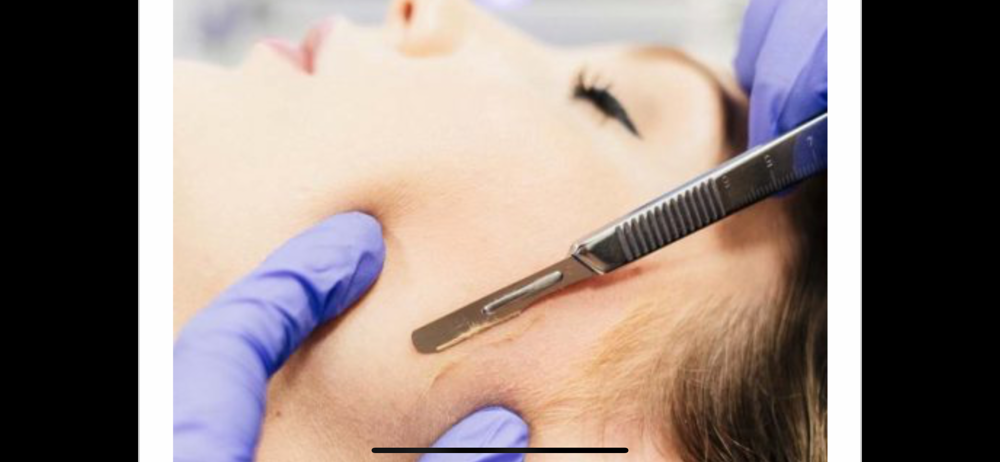 Dermaplane Facial