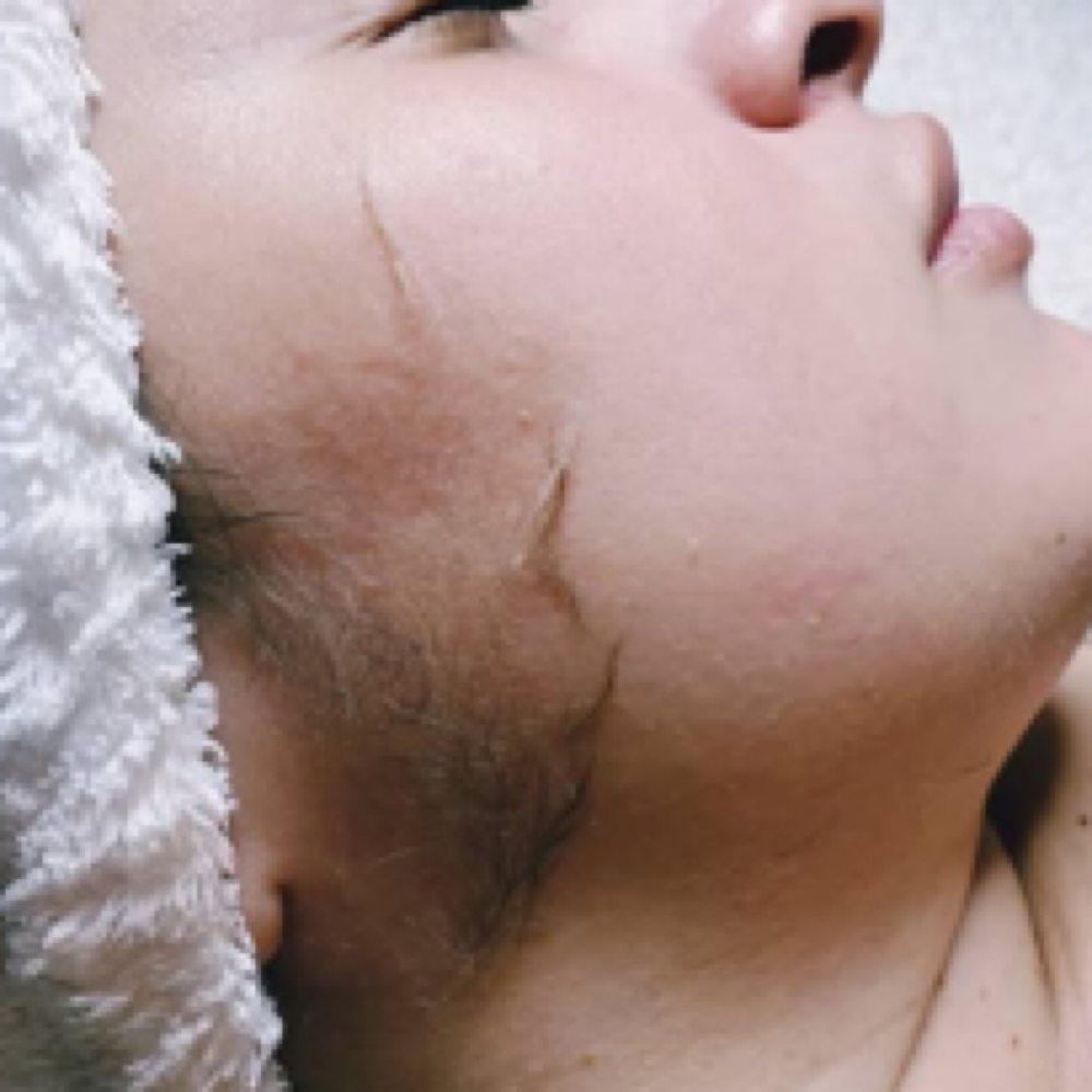 Dermaplaning Facial at Fancy and Feathered in New Windsor, NY