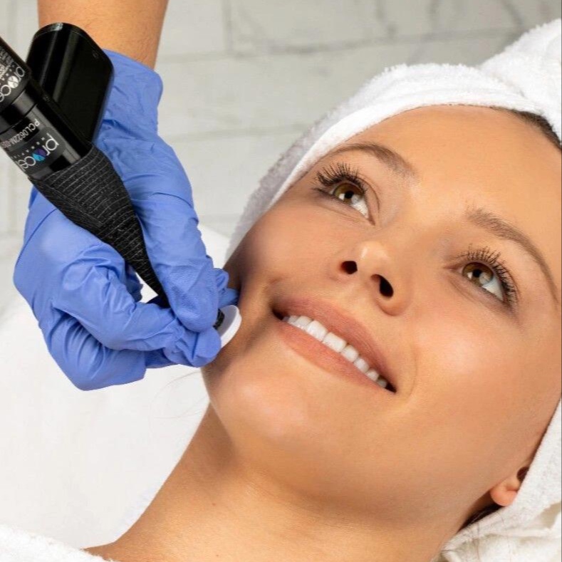 Procell Treatment at Savsthetics in Peabody, MA