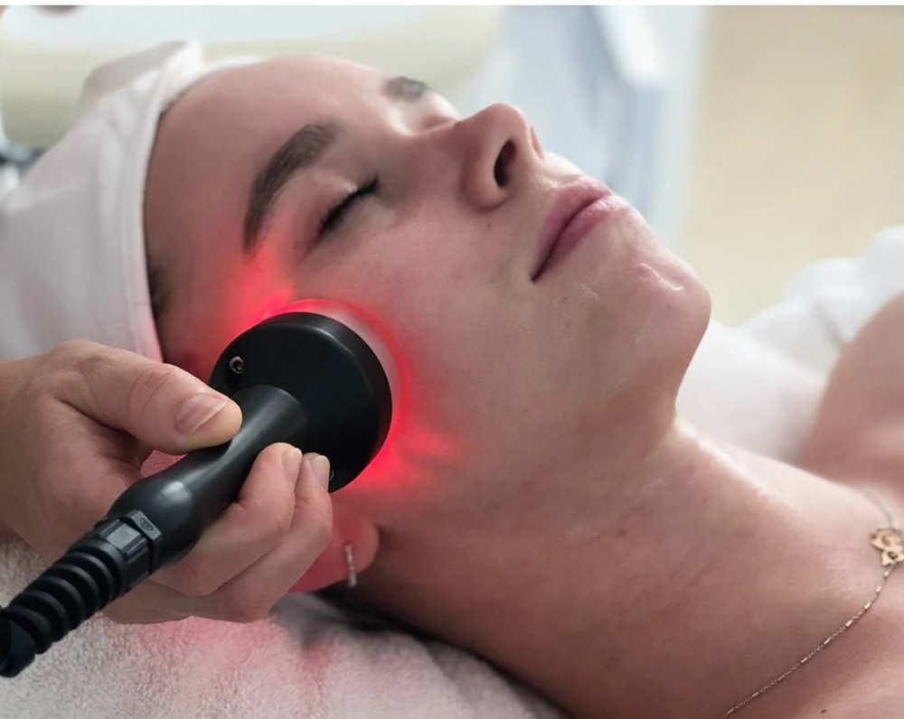 RF Treatment