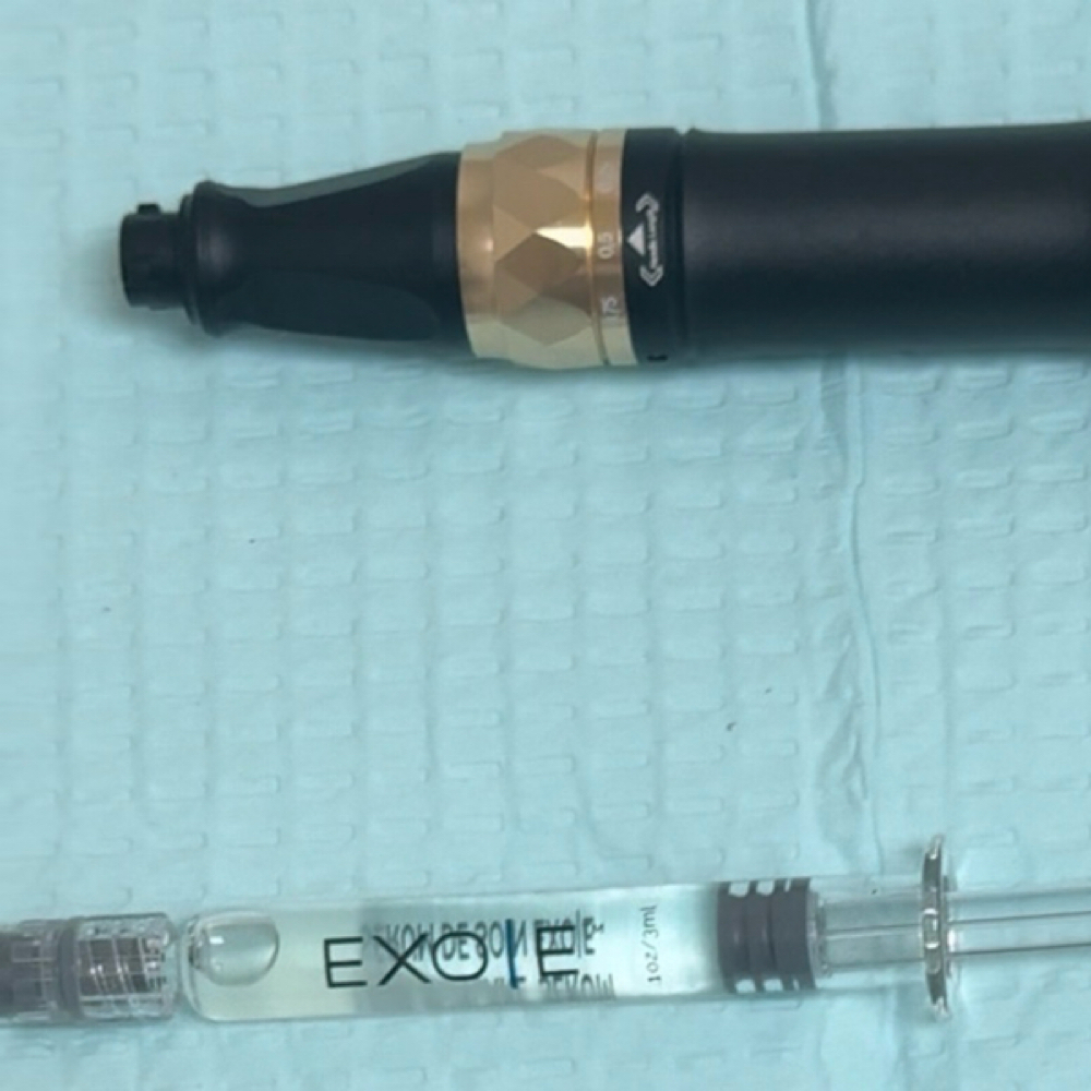 Microneedling With Exosomes at Cherished Aesthetics in Snellville, GA