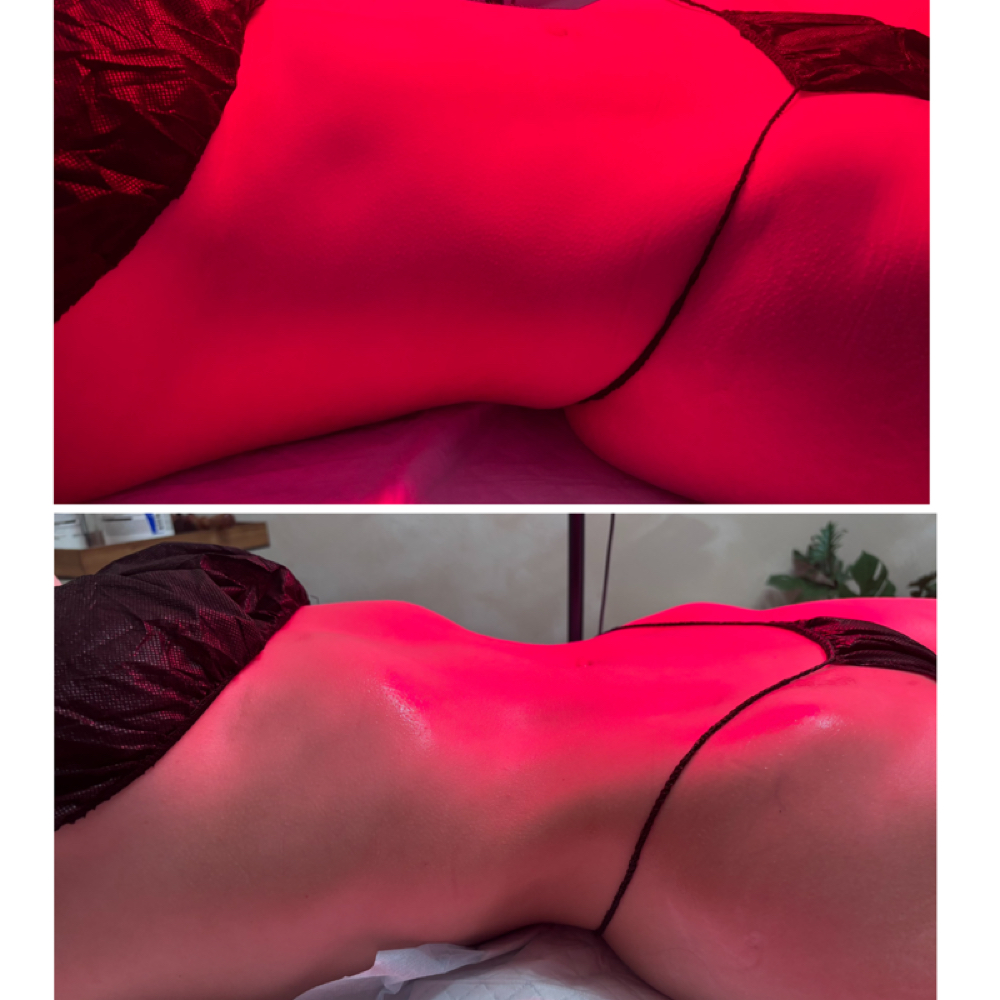 5 Session Package at Iszo Sculpting Llc in Lakewood Co, CO