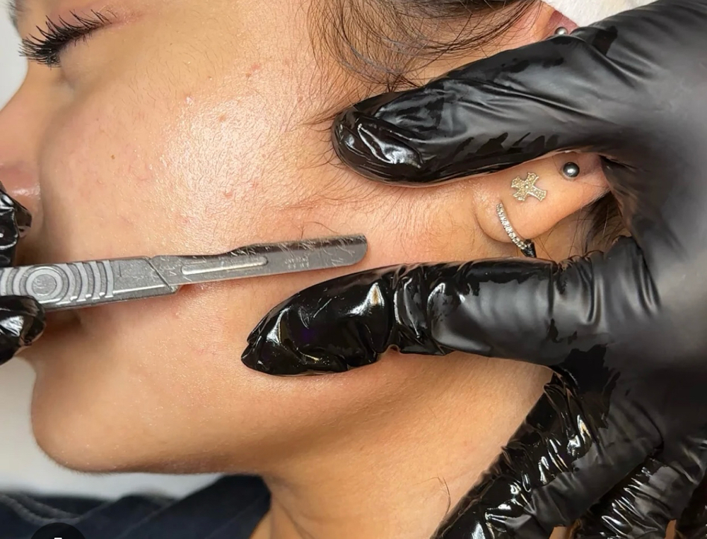 Dermaplane (Add On)