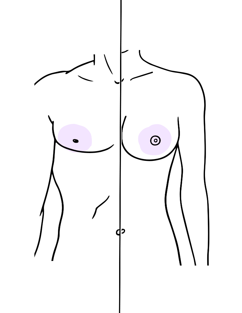 Nipples