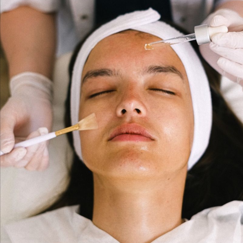 Velvet Touch Custom Peel at Aura and Glow Esthetics in Santa Monica, CA