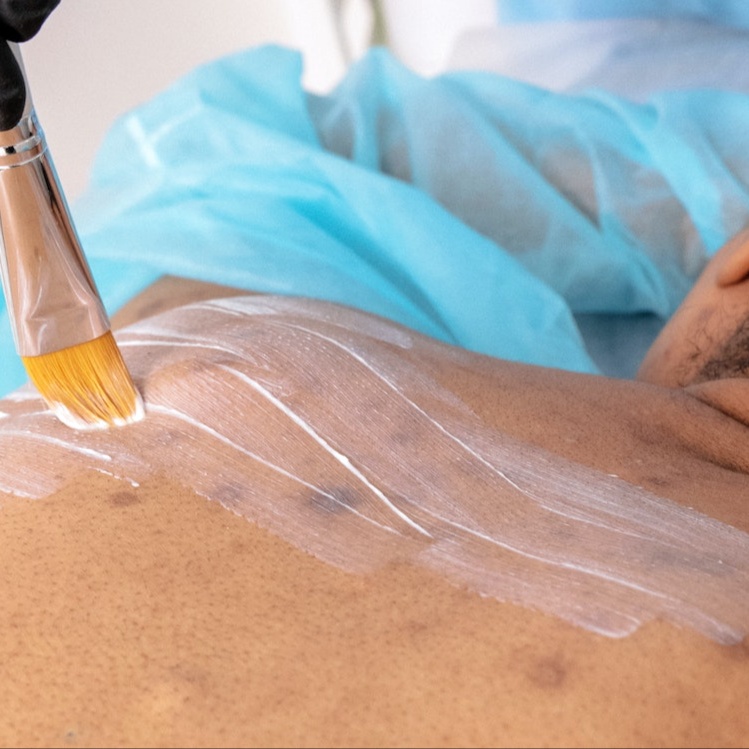 Back Rejuvenation at Ingrid Thompson Skincare in Beverly Hills, CA