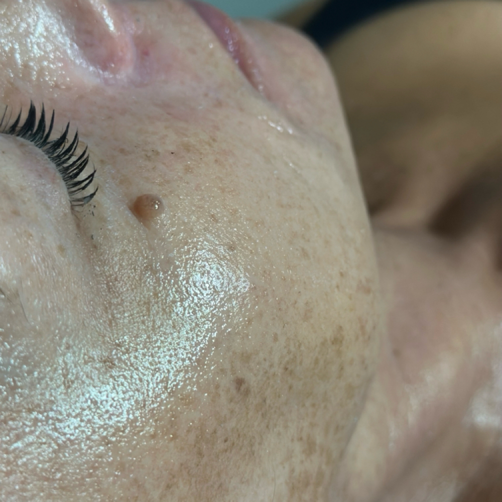 60 Minute Dermaplane Facial at Beauty By Carlie in Boardman, OH