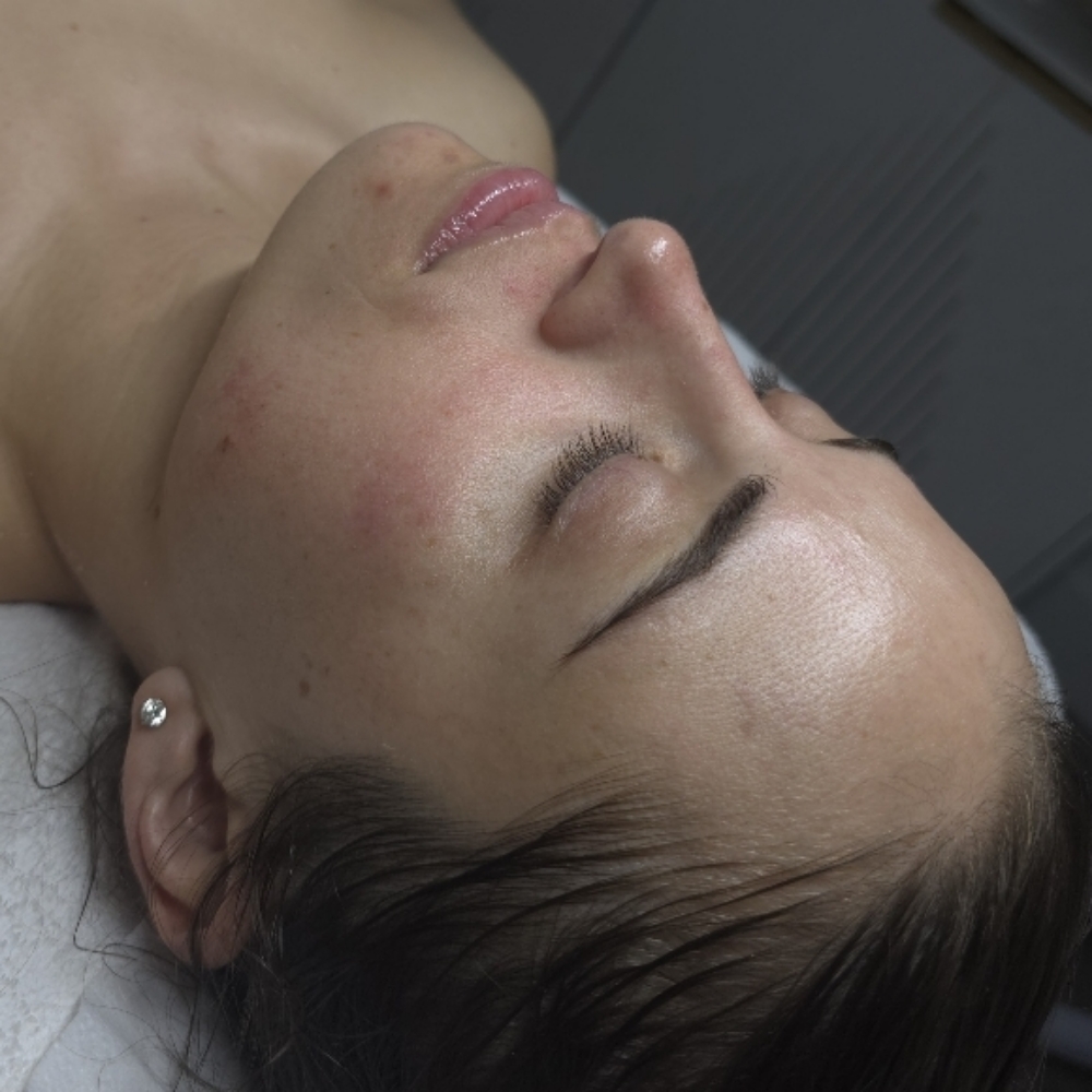 A1 Firming Facial at Stephs A1 Beauty Bar in Southwest Ranches, FL