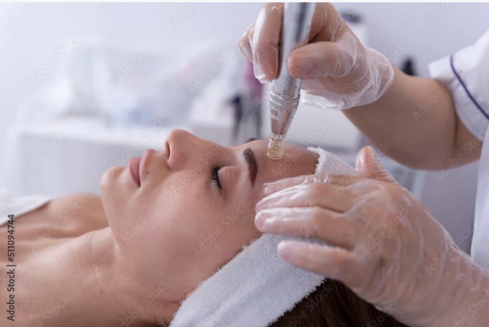 (Needless) Nano Needling