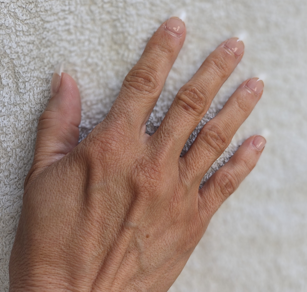 Microneedling Hands