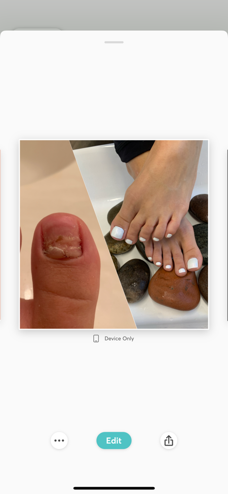 Toe Repair (each)