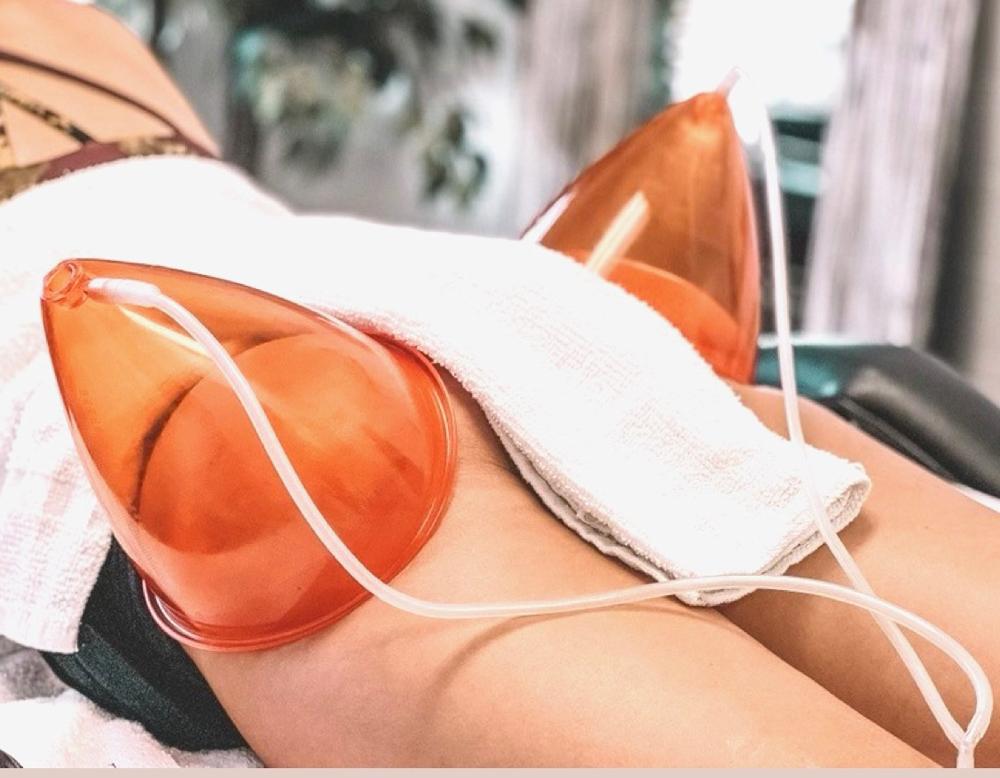 Brazilian Butt Lift