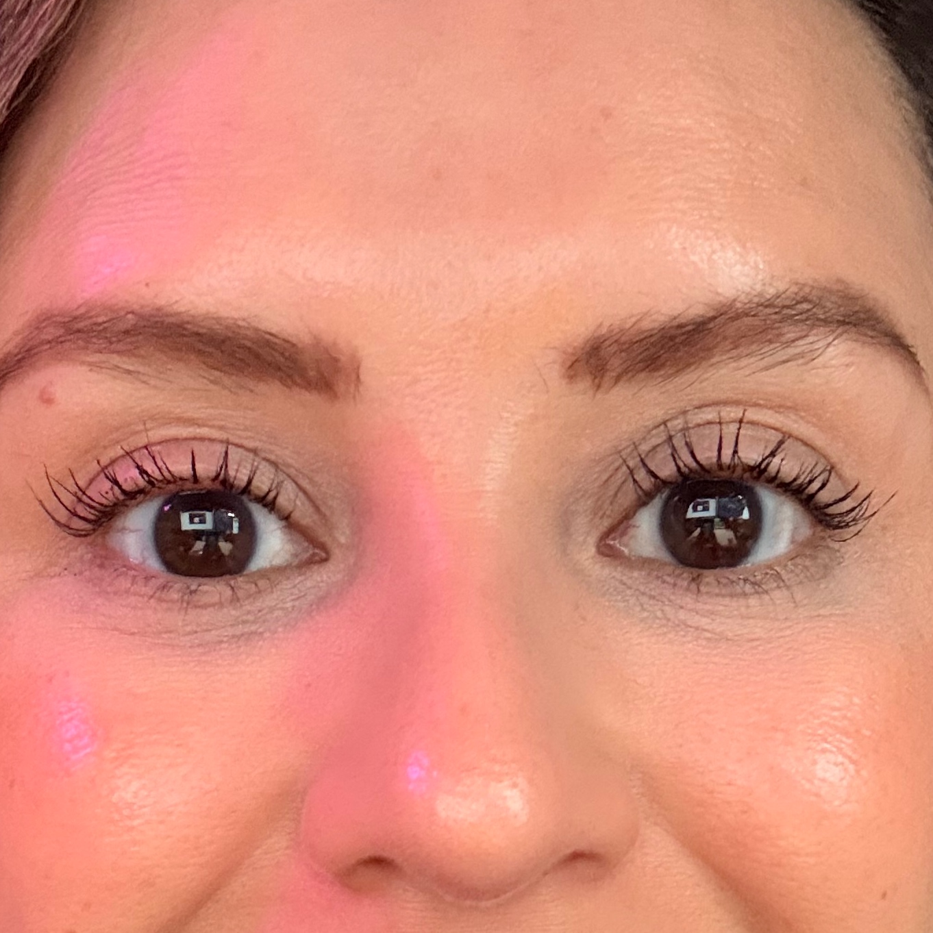 Brow Lift at Radiant Aesthetics by Liz in El Paso, TX
