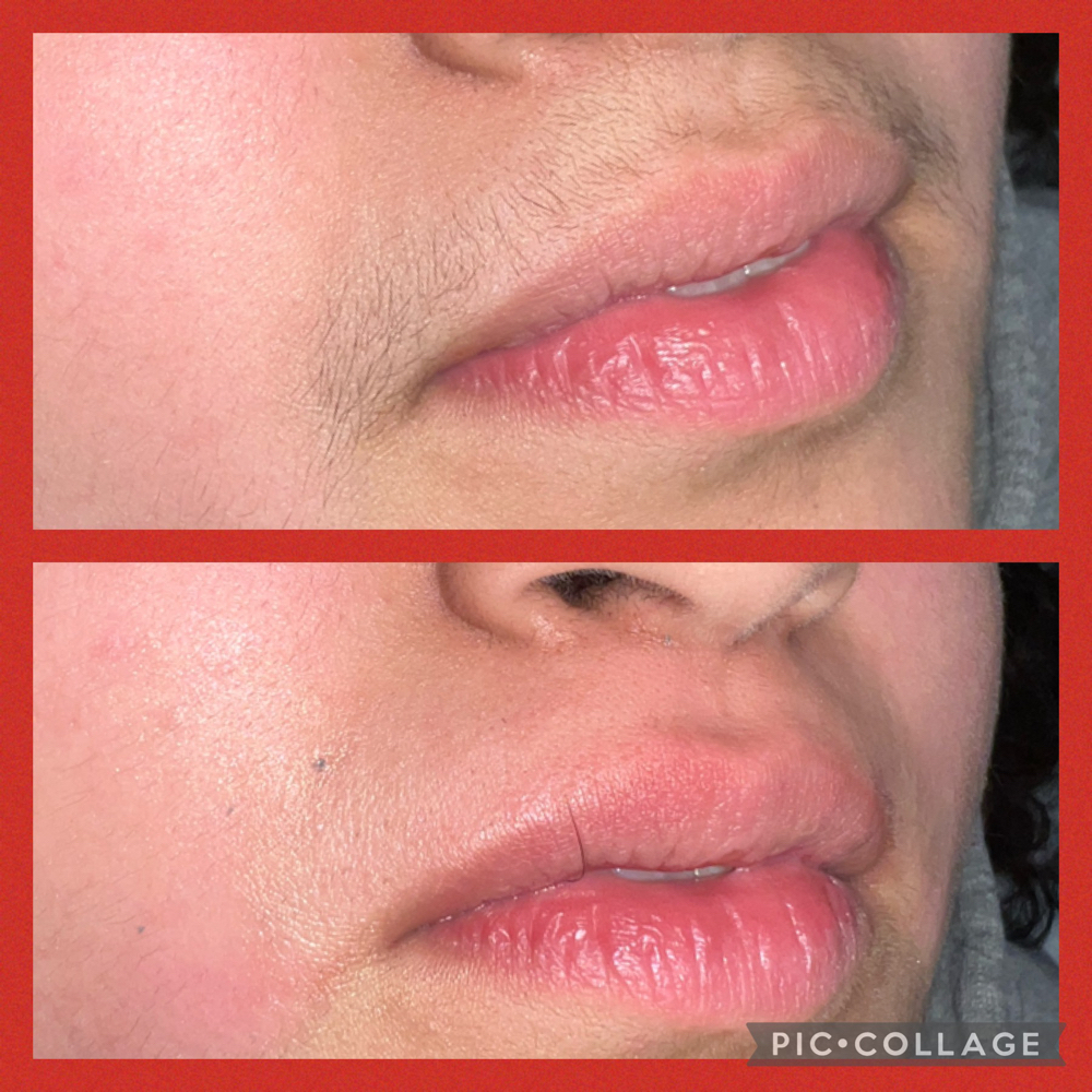 Upper Lip Wax
