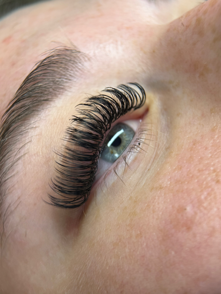 Hybrid Fill at KES Esthetics in Fairmont, WV