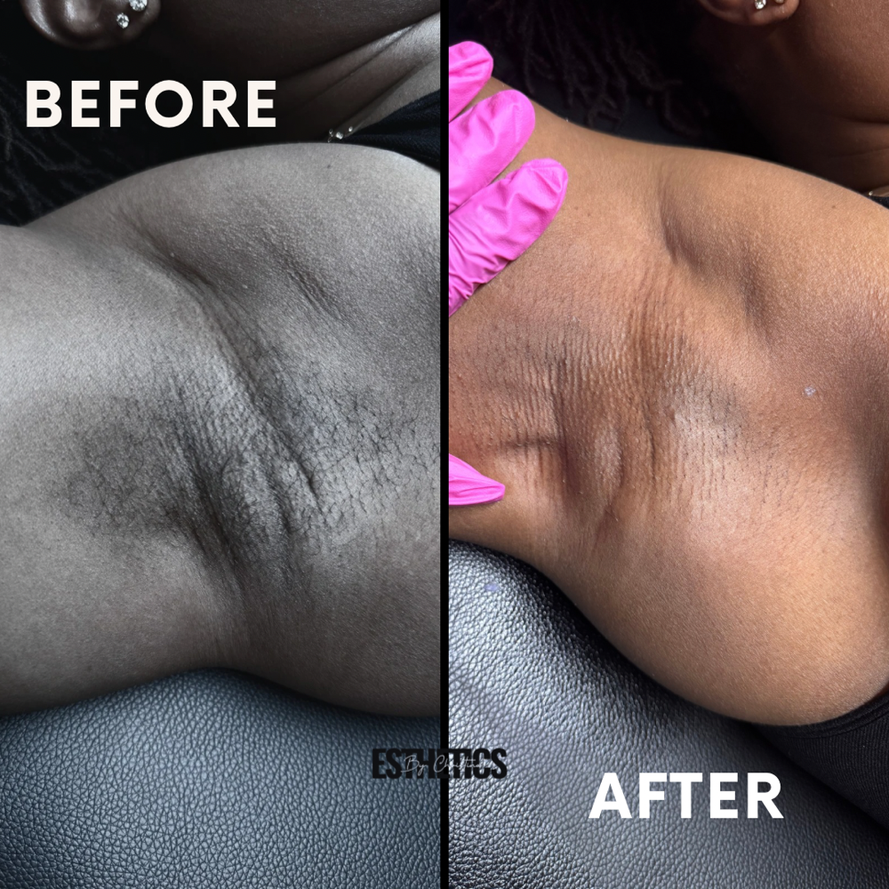 Underarm Wax