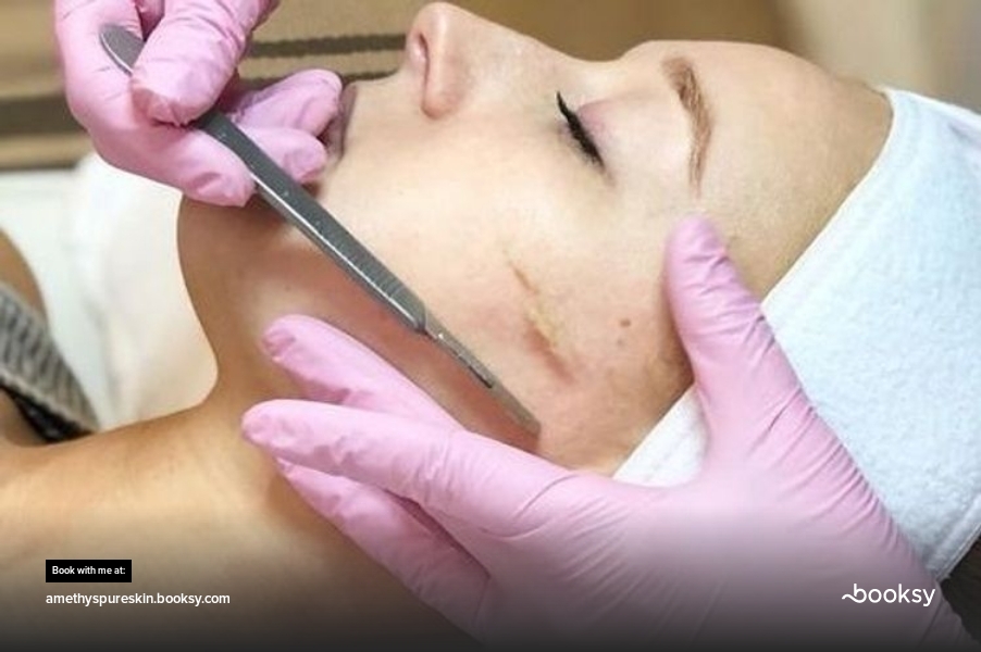 Dermaplaning