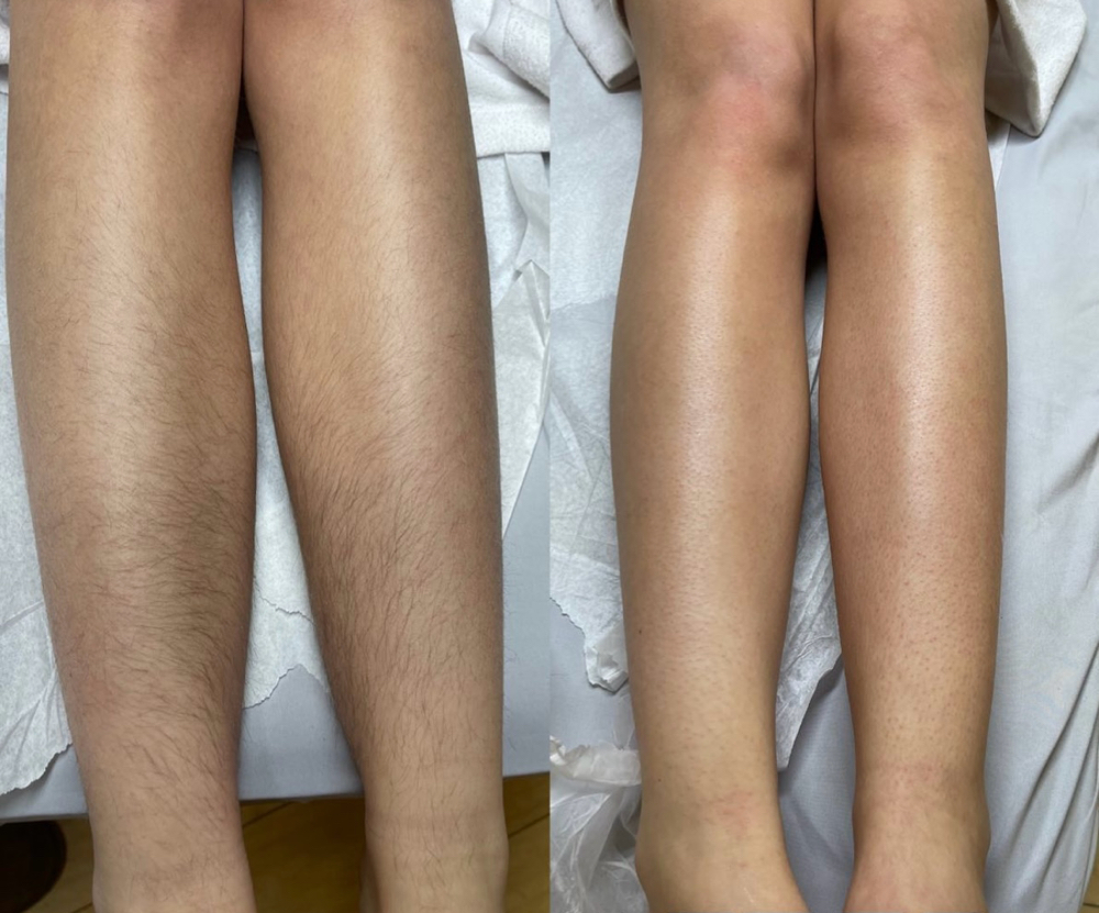 Full Leg Wax