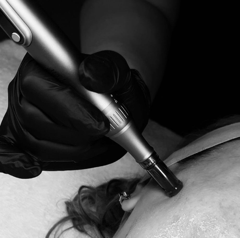 MICRODERMABRASION at Glow Dry Bar in North Arlington, NJ