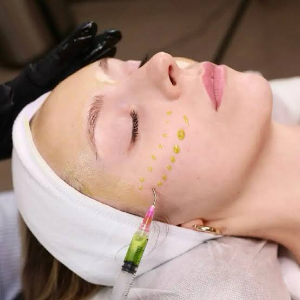 BioSkin Advanced Microneedling at KC Aesthetics Studio in Westport, CT