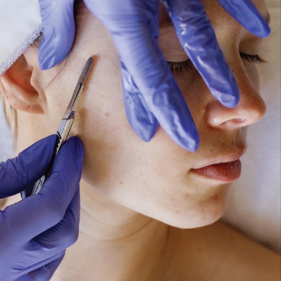 Add On: Dermaplane at Skin Fluent in Hesperia, CA