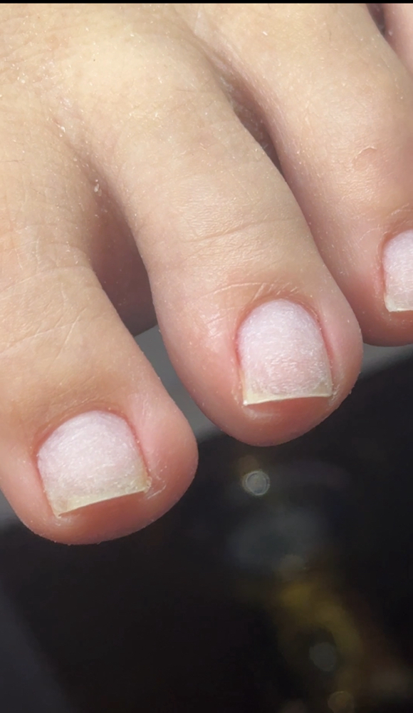 EXTENSIVE TOE CUTICLE CARE