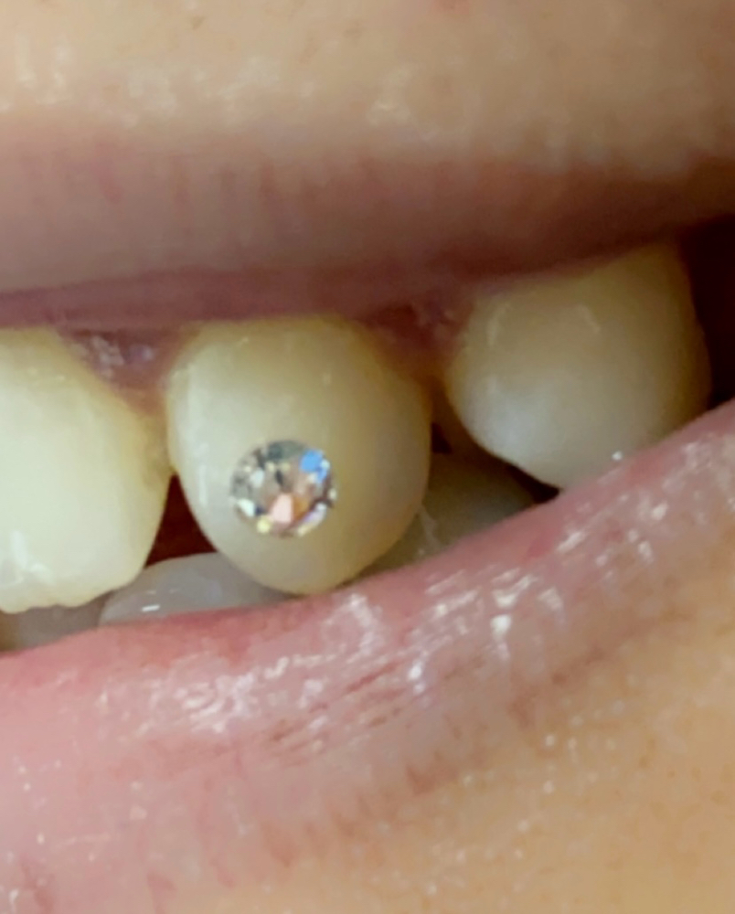 Basic Tooth Gem