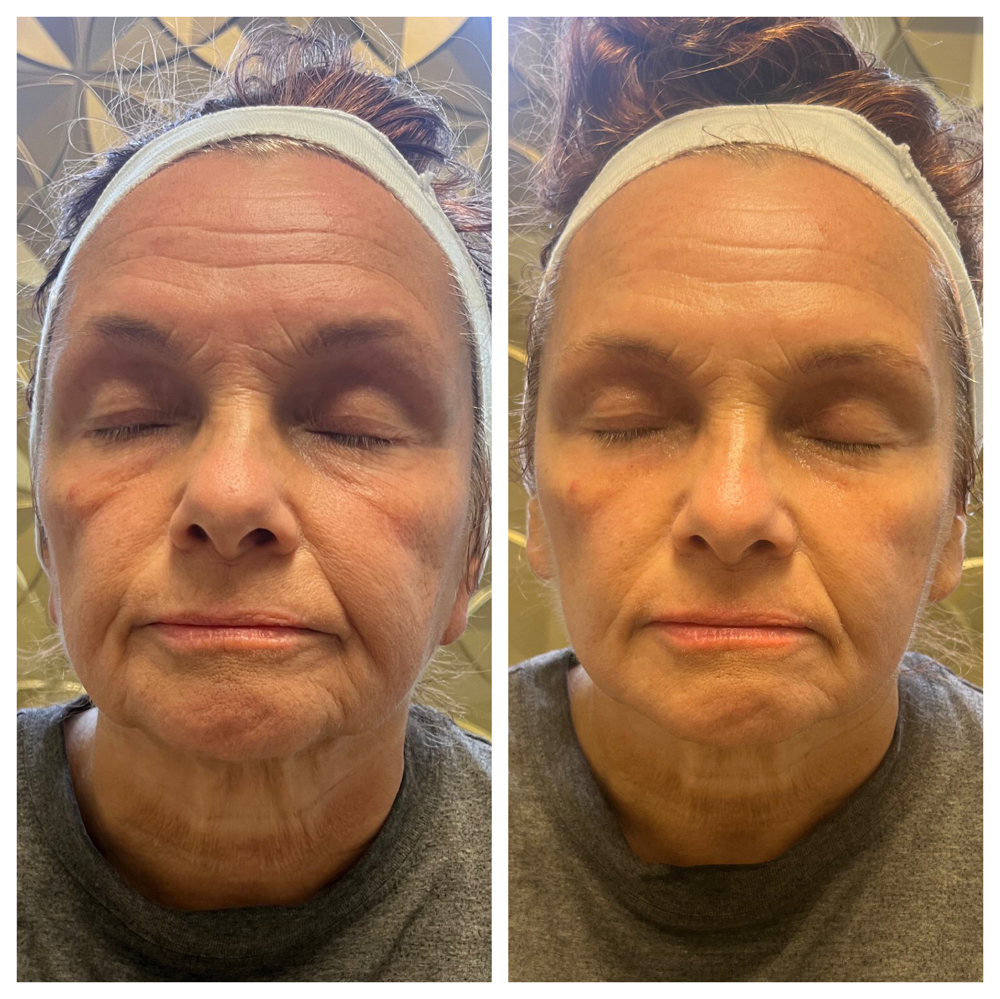 Microcurrent Add On (for Facials)