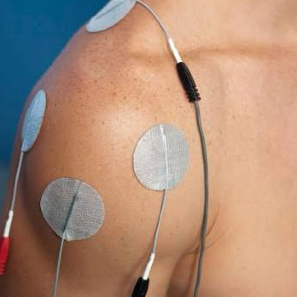 Microcurrent Therapy