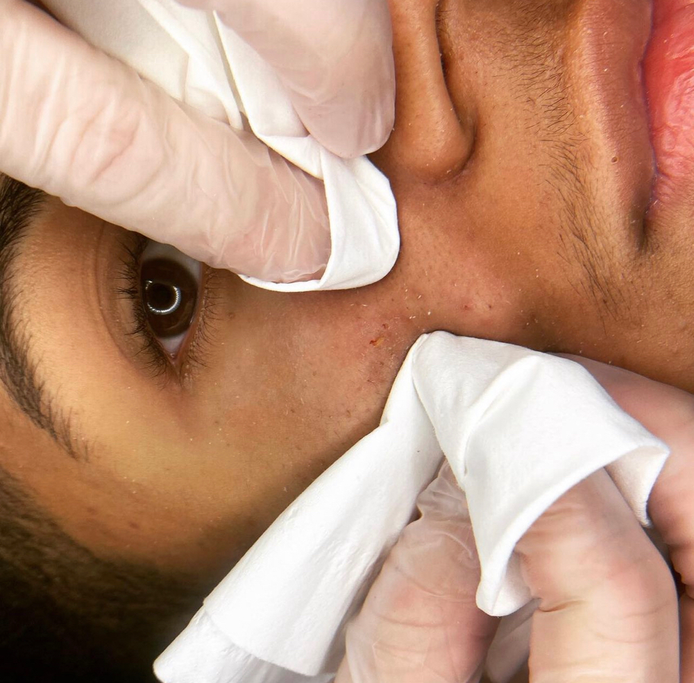 Deep Pore Cleanse