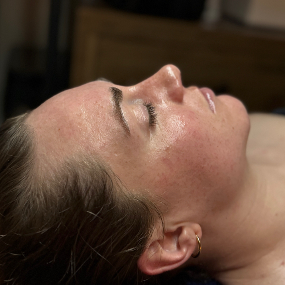 Acne Bootcamp Onboarding at Satin Skin Esthetics in South Glens Falls, NY