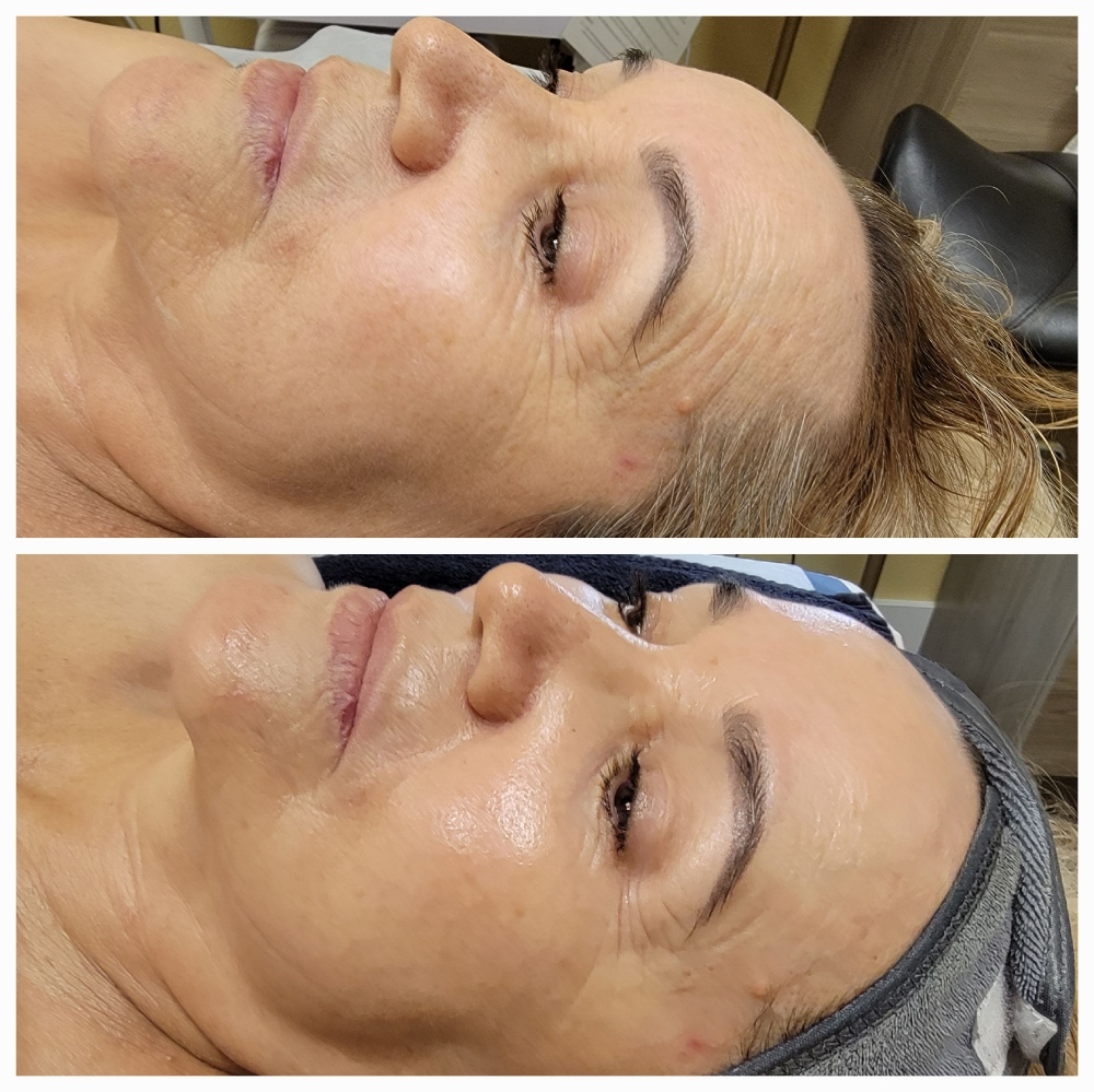 Desired Rejuvenating Facial