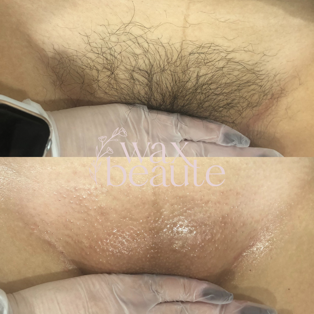 NEW CLIENT Women’s Brazilian Wax