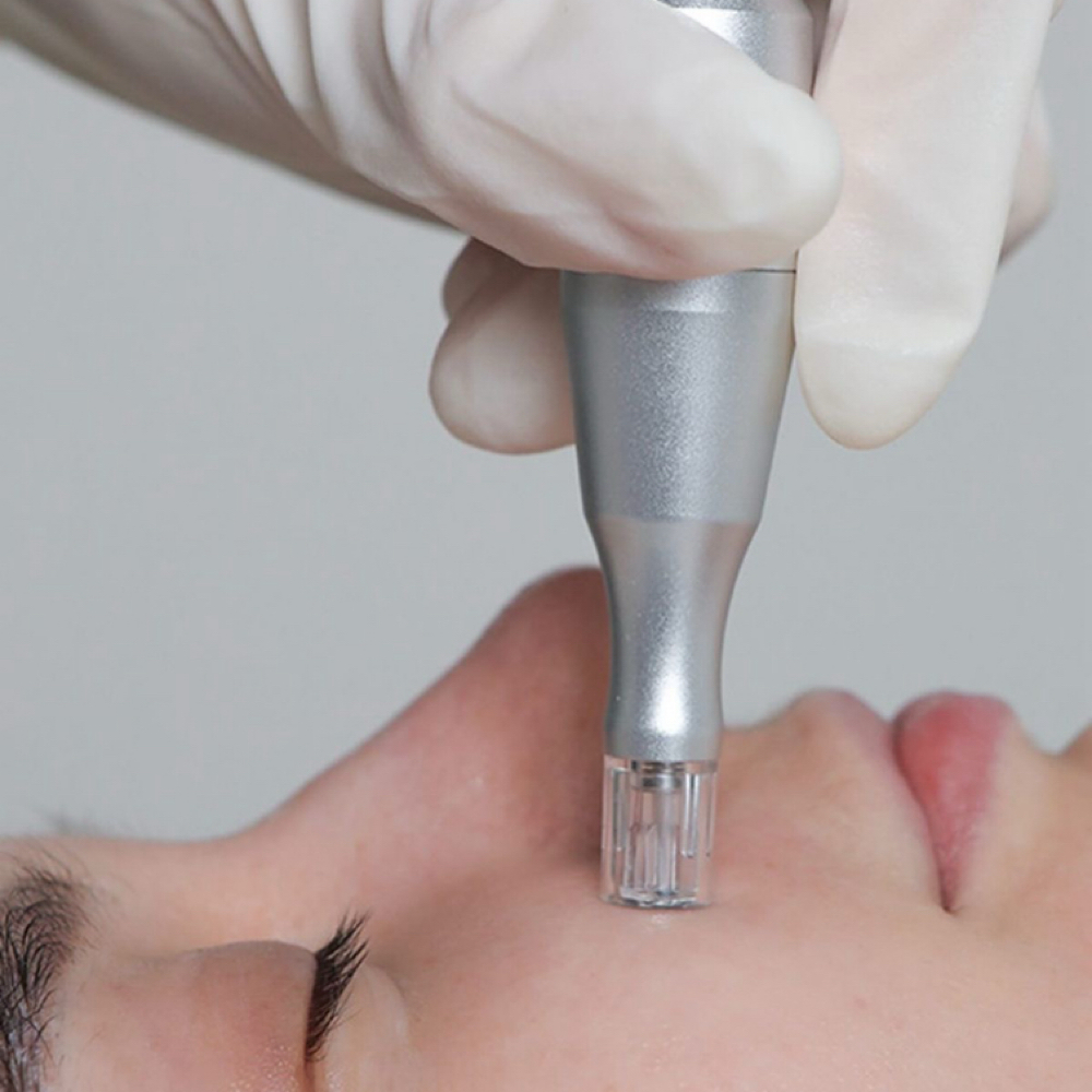 Nano Infusion Facial at L'ATELIER AESTHETIC in Stuart, FL