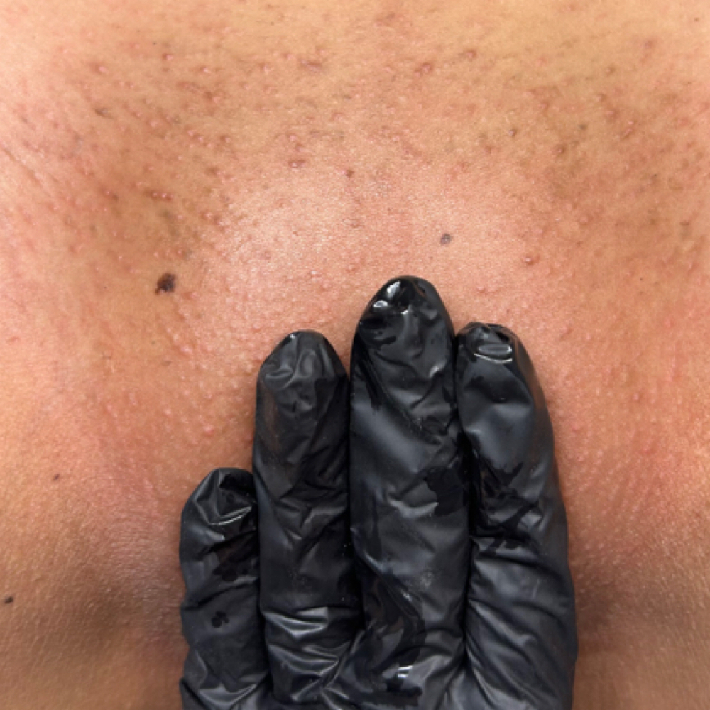 Brazilian wax at LuxurybyLarella in Houston, TX
