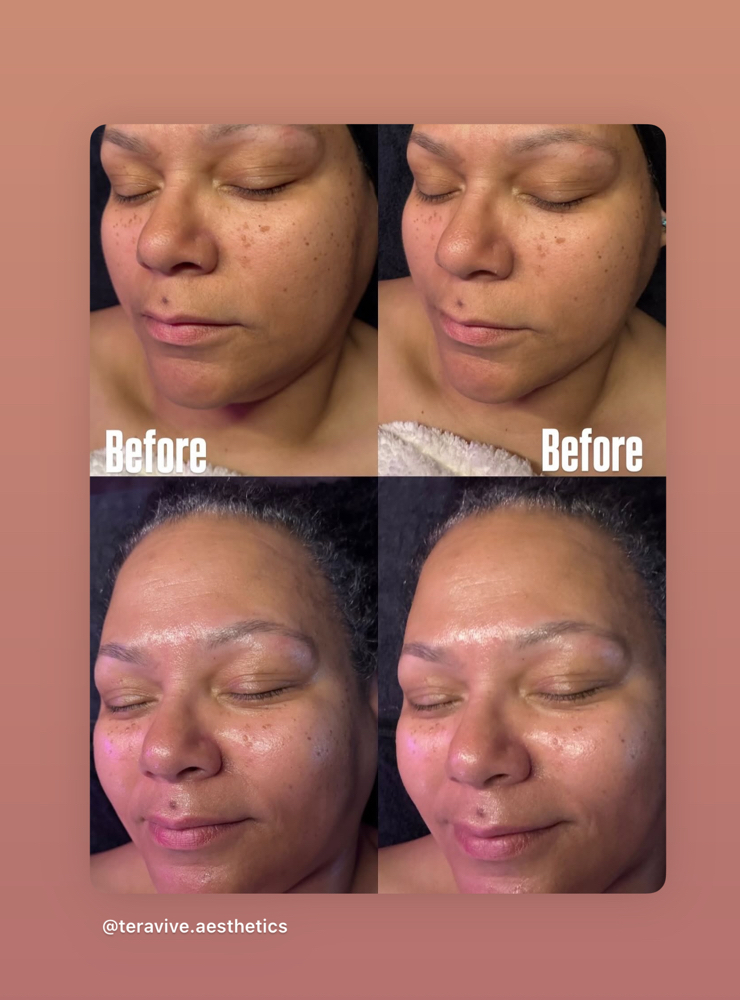Radiance Reset Express Facial
