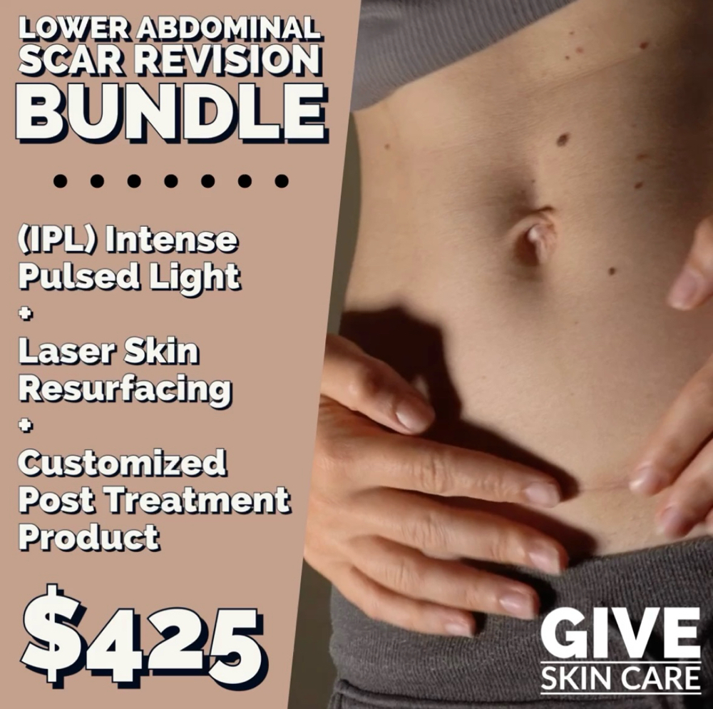 Lower Abs Scar Revision Bundle