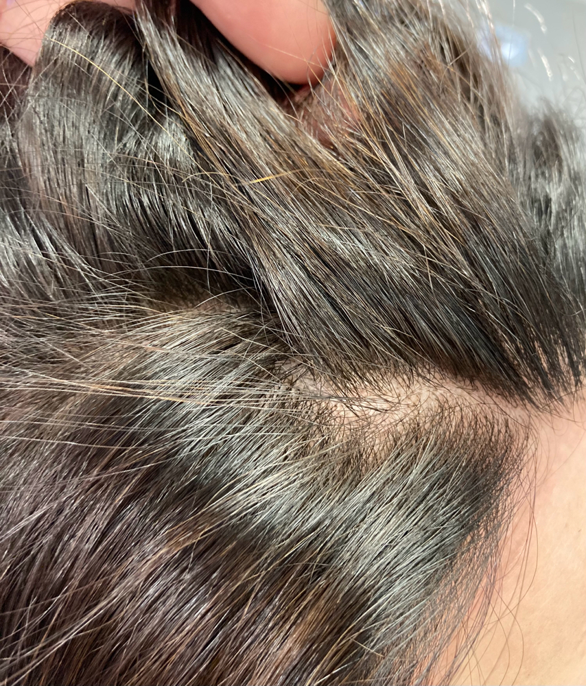 Root Touch Up