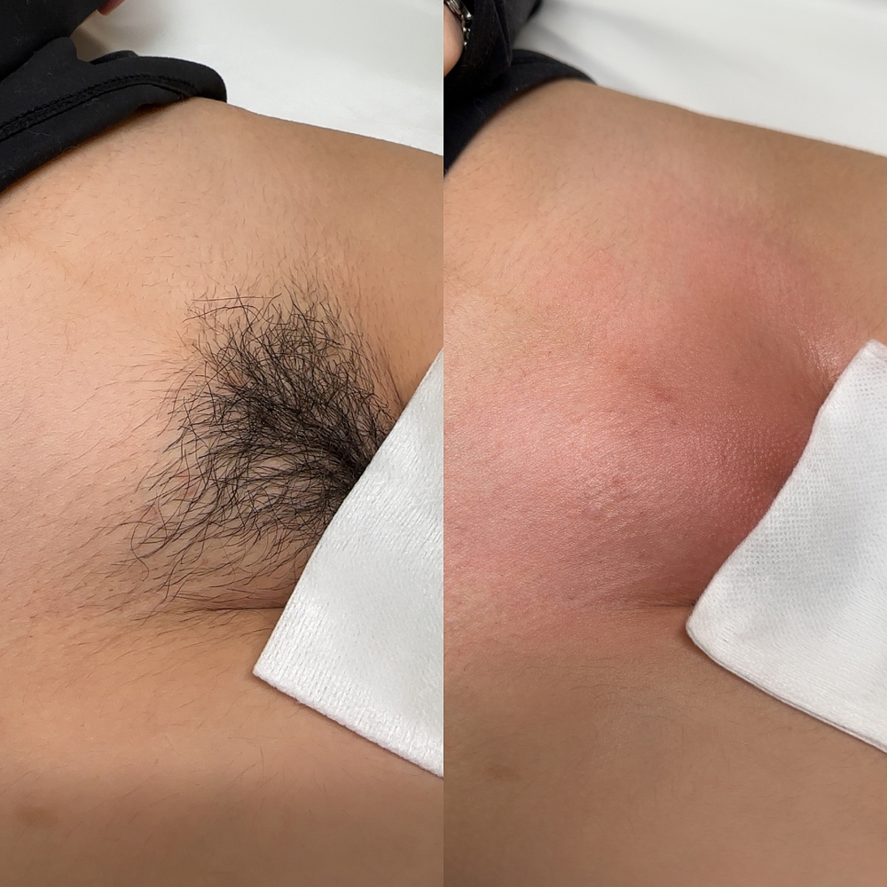 BRAZILLIAN at INVU Beauty Salon in Modesto, CA